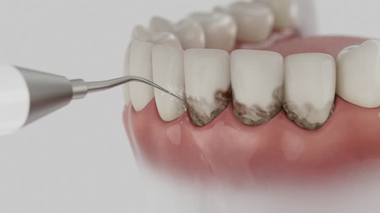 Trusted Tooth Extraction service in Cashion, OK - Dentist Open Now